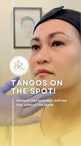 Sam Samara, one of the candidates of the recent Ms. Earth 2024 from Makati,  decided to pay us a visit regarding her concerns about fine lines around  her cheeks. After a consultation