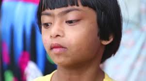 Portrait of young Sri Lankan girl with down syndrome in Ella, Sri Lanka.