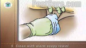 العجان المهبلية غسل التعليم مريضة فيديو الطبية youtube