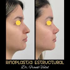 Dr. Frank Vidal Renueva Tu Imagen, Renueva Tu Vida! (@dr.frankvidal) •  Instagram photos and videos