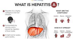 It is a type of viral hepatitis. Hepatitis A Gloveclinic