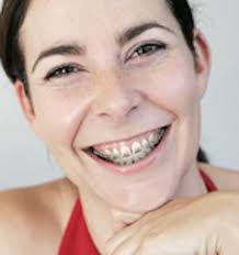 Adults em-brace a better smile