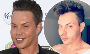 Bobby Norris EXCLUSIVE: TOWIE star admits his beard transplant has made him  'so happy'