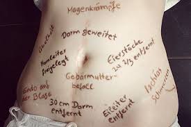Fibromyalgie Die Schmerzen Aus Dem Nichts Brigitte De