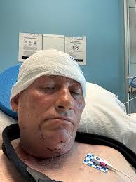 Doug Proctor's Instagram, Twitter & Facebook