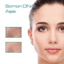 Somon Dna Asisi Pi Sistem Mezoterapisi Cilt Genclestirme Cilt Yenileme Mezoterapisi Hakkinda Detay Bilgi Kolajen Cilt Bakimi Estetik