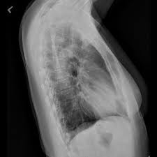 Error code list for version 6.00. Cxdi 710c Cxdi 810c And Cxdi 410c Wireless Digital Radiography Systems Clinical Gallery Canon Medical Systems Usa