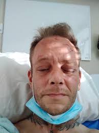 Almost murdered twice