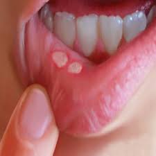 Pin Em Home Remedies