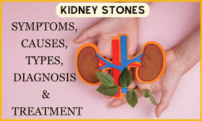 Image result for Calcium Nephrolithiasis