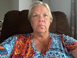 Has anyone had a SMAS neck lift? Here is my before, top left, and now three  weeks out. It's going right back where it was. Doc says skin will tighten  over the