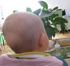 In particolare nei neonati, i capelli, se presenti subito dopo la nascita, sono destinati a cadere nel giro di qualche mese. Post Tricologico Capelli Da Bambini Il Mio Piccolo Pelatone Vita Da Papa