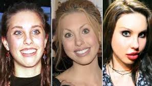 Chloe rose lattanzi left the online world in 2018 in order to focus on healing and creativity. Olivia S Daughter Why So Young Already Plastic Surgery Unbelievable Celebrity Surgery Plastic Surgery Celebrity Plastic Surgery
