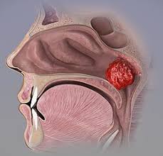 Image result for Adenostemma afrum