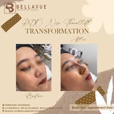 Profile for Bellavue Aesthetic Clinic