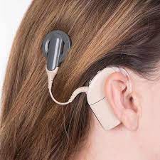 They may help when a hearing aid can't. Cochlear Implant Surgery Johns Hopkins Medicine
