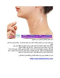 أفضل مركز تجميل بالإسكندرية إزالة الشعر بالليزر بالإسكندرية Hair Care Skin Care Skin