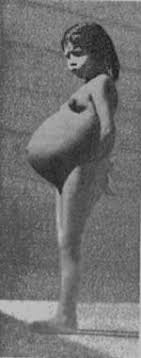 Tanara din judetul vaslui a devenit mama la varsta de 12 ani. Lina Medina Wikipedia