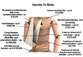 Motorbike Accident Compensation Calculator Motorbike