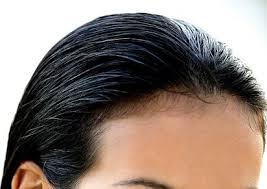 In nhair 30 mins rinse. How To Remove The Smell Of Cologne From Your Body Regrow Hair Forehead Acne Grow Baby Hair