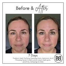 Meet Abbi: The Future of Personalized Skincare Skincare isn't  one-size-fits-all—so why settle for generic products? Abbi is 100%  customized skincare, powered by proprietary AI digital skin analysis.  Here's how it works: 🔅Take