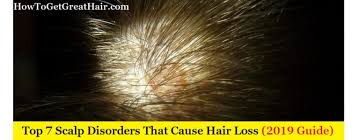 You might be able to reverse hair loss, or at least slow it. Top 7 Scalp Disorders That Cause Hair Loss 2020 Guide How To Get Great Hair
