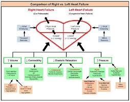 Right Vs Left Heart Failure Left Sided Heart Failure