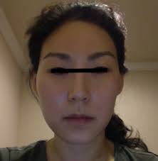 How symmetrical is your face? How To Fix My Asymmetric Face Jawline