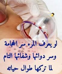 الشفاء بالحجامه الامراض الروحيه والبدنيه Posts Facebook