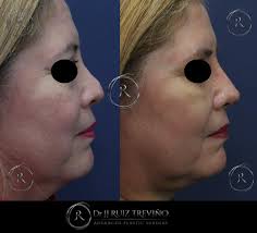 Dr. JJ Ruiz Treviño