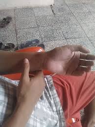 Cara mudah dan cepat hilangkan nyeri perut saat hamil tiap. Self Healing Tips Mengobati Nyeri Dada Dalam 10 Menit Halaman All Kompasiana Com