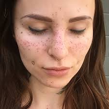 Permanent Freckle Tattoo
