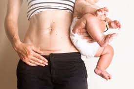 La Cura De Los Puntos Despues Del Parto Eres Mama Cuerpo Despues Del Parto Despues De Una Cesarea Posparto Ejercicio