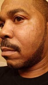 MELVIN DAVIS Obituary (2015)