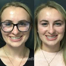 Abby Gaskell's Instagram, Twitter & Facebook