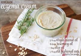 Whipped body butter is perfect for you, with lighter and airier feeling on your skin. Homemade Eczema Cream