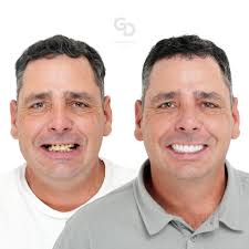 Step into the world of premier dental...