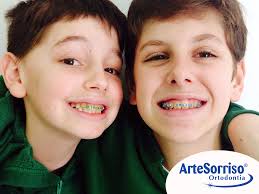 Aparelho Dentario Em Criancas Dentista Ingleses Florianopolis Aparelho Ortodontico