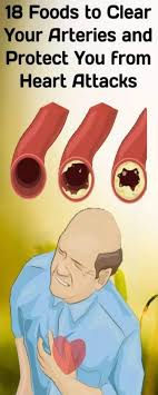 Pin On Health