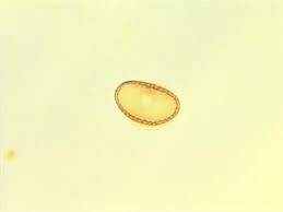 Image result for Leptonychia