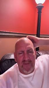 Jimmy Kimmel: What Happened