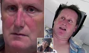 Moment London father is told he has a brain tumour