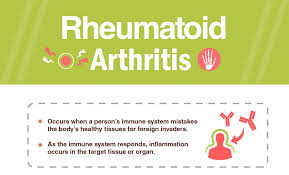 Good relationships, along with a healthy diet, regular exercise, and adequate sleep, are part of a holistic approach to boosting the immune system and protecting yourself from disease. Rheumatoid Arthritis Signs Symptoms Treatment Dr Lal Pathlabs Blog
