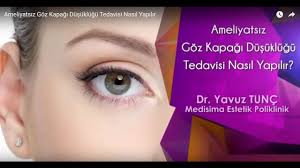 Ameliyatsiz Goz Kapagi Dusuklugu Tedavisi Nasil Yapilir Youtube
