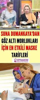 Goz Alti Morluklari Panosundaki Pin