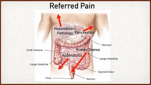 When it occurs on the left side of the body, it causes lower abdominal pain. Abdominal Pain Causes By Location Stomach Anatomy And Quadrants Ezmed