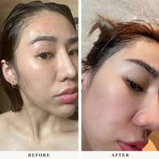 Skin Whitening Supplements in SG