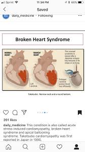 Pin By Brooke Richeson On Culture Broken Heart Syndrome Takotsubo Normal Heart