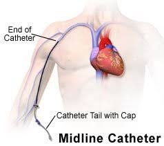 Caring For A Peripherally Inserted Central Catheter Or Midline Catheter Discharge Care What You Need To Know