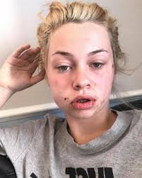 Attacker yells 'it's your time to die' as mum, 18, is knocked unconscious